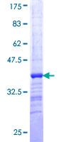Ls18766 Protein - 12.5% SDS-PAGE Stained with Coomassie Blue.