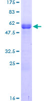LSAMP / LAMP Protein - 12.5% SDS-PAGE of human LSAMP stained with Coomassie Blue