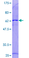 LSD / DNASE1L3 Protein - 12.5% SDS-PAGE of human DNASE1L3 stained with Coomassie Blue