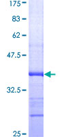 LSD / DNASE1L3 Protein - 12.5% SDS-PAGE Stained with Coomassie Blue.