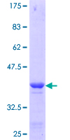 LSM1 Protein - 12.5% SDS-PAGE Stained with Coomassie Blue.