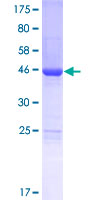 LSM12 Protein - 12.5% SDS-PAGE of human LSM12 stained with Coomassie Blue
