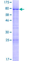 LSM14A Protein - 12.5% SDS-PAGE of human LSM14A stained with Coomassie Blue