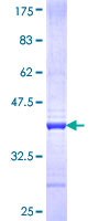 LSM2 / SnRNP Protein - 12.5% SDS-PAGE Stained with Coomassie Blue.