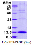 LSM2 / SnRNP Protein