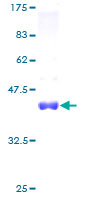 LSM3 Protein - 12.5% SDS-PAGE of human LSM3 stained with Coomassie Blue