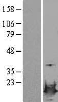 LSM4 Protein - Western validation with an anti-DDK antibody * L: Control HEK293 lysate R: Over-expression lysate