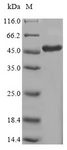 LSM4 Protein - (Tris-Glycine gel) Discontinuous SDS-PAGE (reduced) with 5% enrichment gel and 15% separation gel.