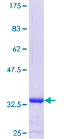 LSM4 Protein - 12.5% SDS-PAGE Stained with Coomassie Blue.