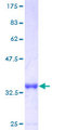 LSM6 Protein - 12.5% SDS-PAGE of human LSM6 stained with Coomassie Blue