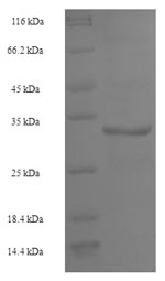LSP1 Protein - (Tris-Glycine gel) Discontinuous SDS-PAGE (reduced) with 5% enrichment gel and 15% separation gel.