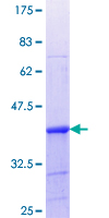 LSP1 Protein - 12.5% SDS-PAGE Stained with Coomassie Blue.