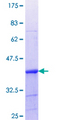 LSP1 Protein - 12.5% SDS-PAGE Stained with Coomassie Blue.