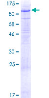 LSR / LISCH7 Protein - 12.5% SDS-PAGE of human LSR stained with Coomassie Blue
