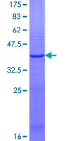 LSS Protein - 12.5% SDS-PAGE Stained with Coomassie Blue.