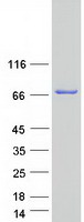 LSS Protein - Purified recombinant protein LSS was analyzed by SDS-PAGE gel and Coomassie Blue Staining