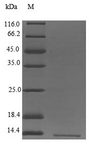LST1 Protein - (Tris-Glycine gel) Discontinuous SDS-PAGE (reduced) with 5% enrichment gel and 15% separation gel.