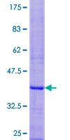 LST1 Protein - 12.5% SDS-PAGE of human LST1 stained with Coomassie Blue