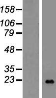LTA / TNF Beta Protein - Western validation with an anti-DDK antibody * L: Control HEK293 lysate R: Over-expression lysate