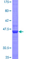 LTA / TNF Beta Protein - 12.5% SDS-PAGE of human LTA stained with Coomassie Blue