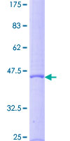 LTA / TNF Beta Protein - 12.5% SDS-PAGE of human LTA stained with Coomassie Blue