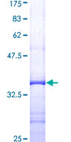 LTA / TNF Beta Protein - 12.5% SDS-PAGE Stained with Coomassie Blue.