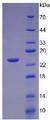 LTA / TNF Beta Protein - Active Tumor Necrosis Factor Beta (TNFb) by SDS-PAGE