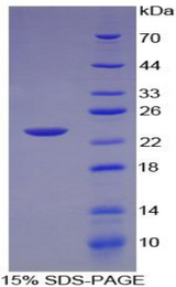 LTA / TNF Beta Protein - Recombinant Tumor Necrosis Factor Beta By SDS-PAGE