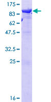 LTA4H / LTA4 Protein - 12.5% SDS-PAGE of human LTA4H stained with Coomassie Blue