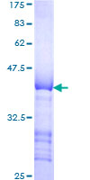 LTBP1 / LTBP-1 Protein - 12.5% SDS-PAGE Stained with Coomassie Blue.