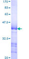 LTBP1 / LTBP-1 Protein - 12.5% SDS-PAGE Stained with Coomassie Blue.