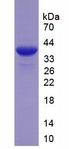 LTBP2 Protein - Recombinant Latent Transforming Growth Factor Beta Binding Protein 2 By SDS-PAGE