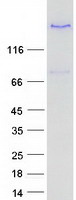 LTBP3 / LTBP-3 Protein - Purified recombinant protein LTBP3 was analyzed by SDS-PAGE gel and Coomassie Blue Staining