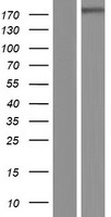 LTBP4 Protein - Western validation with an anti-DDK antibody * L: Control HEK293 lysate R: Over-expression lysate