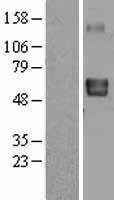 LTBR Protein - Western validation with an anti-DDK antibody * L: Control HEK293 lysate R: Over-expression lysate