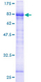 LTBR Protein - 12.5% SDS-PAGE of human LTBR stained with Coomassie Blue