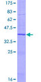 LTC4S / LTC4 Synthase Protein - 12.5% SDS-PAGE of human LTC4S stained with Coomassie Blue