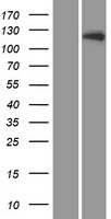 LTK Protein - Western validation with an anti-DDK antibody * L: Control HEK293 lysate R: Over-expression lysate