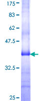 LTK Protein - 12.5% SDS-PAGE Stained with Coomassie Blue.
