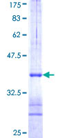LTN1 / RNF160 Protein - 12.5% SDS-PAGE Stained with Coomassie Blue.
