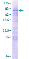 LUC7L2 Protein - 12.5% SDS-PAGE of human LUC7L2 stained with Coomassie Blue