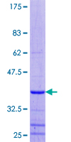 LUC7L3 / CROP Protein - 12.5% SDS-PAGE of human CROP stained with Coomassie Blue