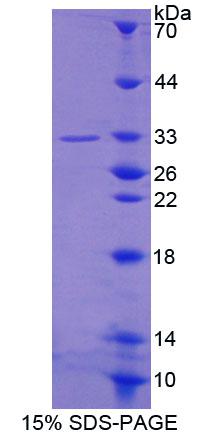 LUC7L3 / CROP Protein - Recombinant Cisplatin Resistance Associated Overexpressed Protein By SDS-PAGE
