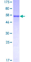 Lumican Protein - 12.5% SDS-PAGE of human LUM stained with Coomassie Blue