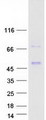 Lumican Protein - Purified recombinant protein LUM was analyzed by SDS-PAGE gel and Coomassie Blue Staining