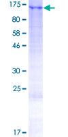 LUZP1 Protein - 12.5% SDS-PAGE of human LUZP1 stained with Coomassie Blue