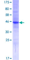 LVRN / Laeverin Protein - 12.5% SDS-PAGE Stained with Coomassie Blue