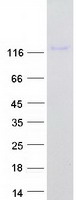 LVRN / Laeverin Protein - Purified recombinant protein LVRN was analyzed by SDS-PAGE gel and Coomassie Blue Staining