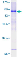 LW-1 / HSFX1 Protein - 12.5% SDS-PAGE of human LW-1 stained with Coomassie Blue