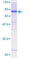 LW-1 / HSFX1 Protein - 12.5% SDS-PAGE of human LW-1 stained with Coomassie Blue